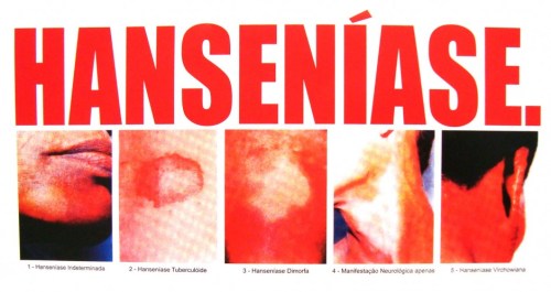 hanseniase01-940x500